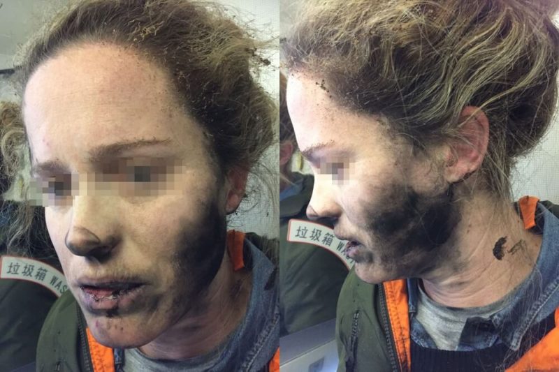 Bluetooth Headphones Explode on Airline Passenger's Neck