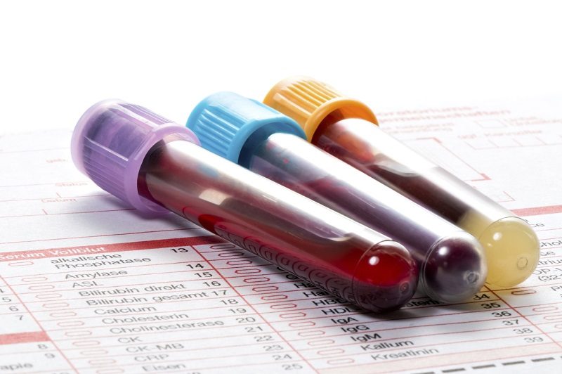 blood test death science medicine